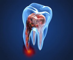 FAD-ECM-Endodonzia-Odontoiatri-250