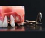 Dentista-FAD-ECM-odontoiatri_implantologia_dc2_2020_ac1